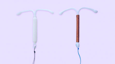 IUD Options 2023: Types, Benefits, Side Effects, How To Choose